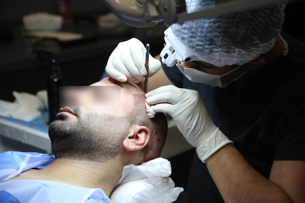 Dr. Merdan Celik – Haartransplantation Köln